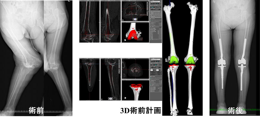 膝関節外科学 南江堂 膝関節外科学: 書籍／南江堂